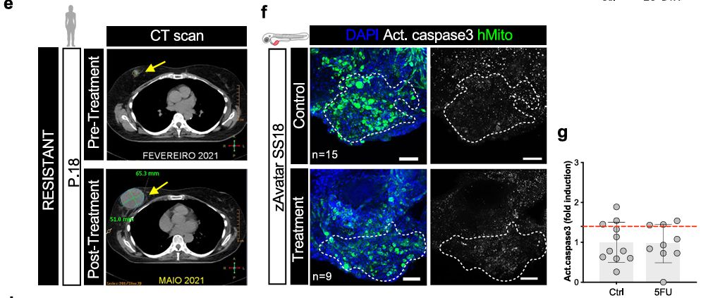 Zebrafish xenograft tumor imaging showing treatment response.