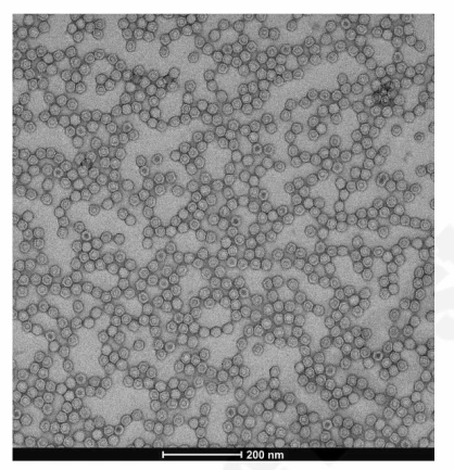 Negative staining TEM micrograph of AAV particles for sample quality assessment.