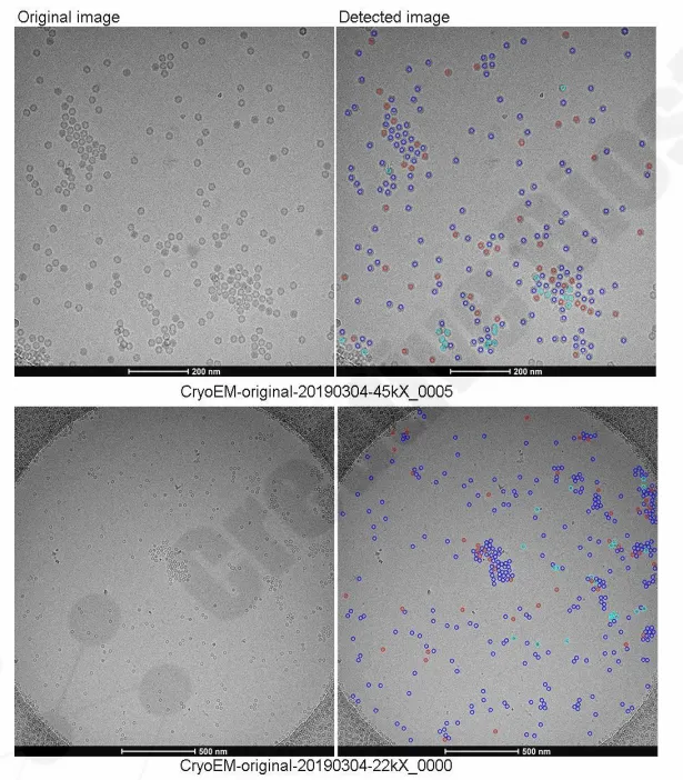 X-ray diffraction pattern collected from an XYZ-DNA/RNA complex crystal.