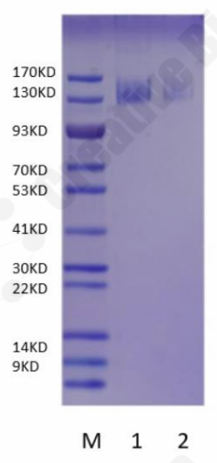 SDS-PAGE validation of antibody bead conjugation efficiency for affinity chromatography.