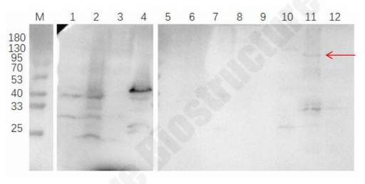 Western blot showing tissue-specific detection of R1 complex B subunit at 130 kDa in spleen RIPA sample.