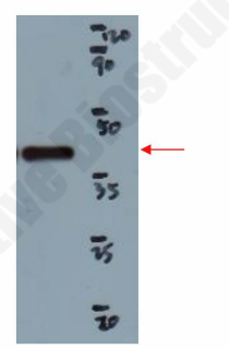 Western blot validation of purified F2 receptor using anti-FLAG antibody.