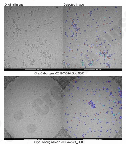Mempro software auto-detection of full, empty, and uncertain particles.