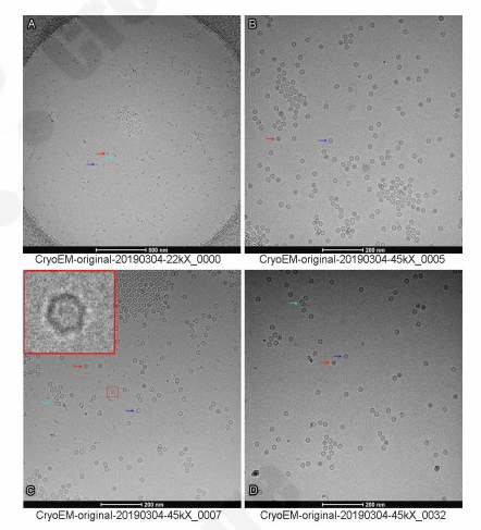 Cryo-EM micrograph showing full, empty, and uncertain AAV particles.