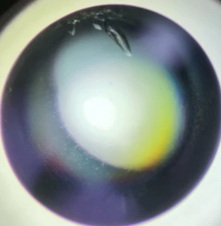 Protein crystal mounted on a nylon loop under polarized light for X-ray diffraction.